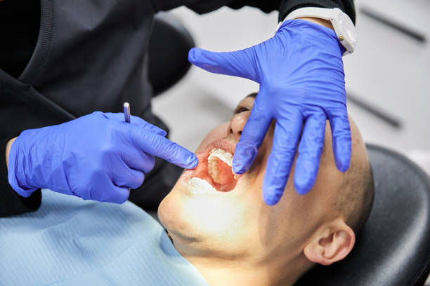 Best Emergency Broken Tooth Repair in Fabens, TX